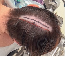 Mulher com a mão no rosto

Descrição gerada automaticamente com confiança baixa